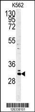 Anti-C2orf49 Rabbit Polyclonal Antibody (Biotin)