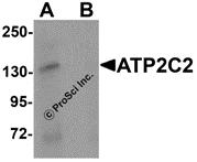 Western blot analysis of ATP2C2 in 3T3 cell lysate with ATP2C2 antibody at 1 &#956;g/mL in (A) the absence and (B) the presence of blocking peptide.