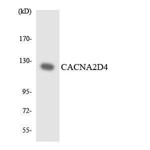 Western blot analysis of the lysates from COLO205 cells using Anti-CACNA2D4 Antibody