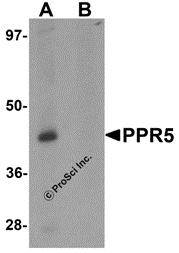 Western blot analysis of PRR5 in SK-N-SH cell lysate with PRR5 antibody at 1 &#956;g/mL in (A) the absence and (B) the presence of blocking peptide.