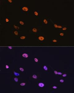 Immunofluorescence analysis of C6 cells using Anti-TDP43 Antibody [ARC0492] (A306079) at a dilution of 1:100 (40x lens). DAPI was used to stain the cell nuclei (blue).