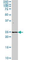 Anti-NTMT1 Mouse Polyclonal Antibody