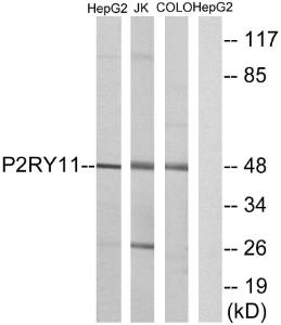 Western blot analysis of lysates from HepG Jurkat, and COLO cells using Anti-P2RY11 Antibody. The right hand lane represents a negative control, where the antibody is blocked by the immunising peptide