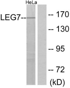 Anti-Galectin 7 Rabbit Polyclonal Antibody