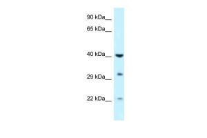 Anti-GALK1 Rabbit Polyclonal Antibody