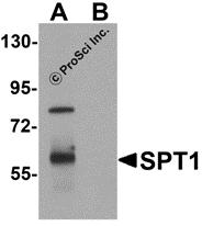 Western blot analysis of SPT1 in human lung tissue lysate with SPT1 antibody at 1 µg/mL in (A) the absence and (B) the presence of blocking peptide.