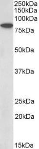 Anti-BBS7 Antibody (A83000) (0.5µg/ml) staining of Rat Skeletal Muscle lysate (35µg protein in RIPA buffer). Primary incubation was 1 hour. Detected by chemiluminescence.