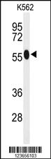 Anti-ACSM1 Rabbit Polyclonal Antibody