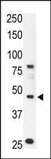 Anti-CCBP2 Rabbit Polyclonal Antibody