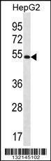 Anti-MGAT4C Rabbit Polyclonal Antibody (APC (Allophycocyanin))