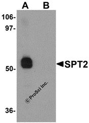 Western blot analysis of SPT2 in 3T3 cell lysate with SPT2 antibody at 1 µg/mL in (A) the absence and (B) the presence of blocking peptide.