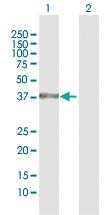 Anti-NR1I3 Rabbit Polyclonal Antibody