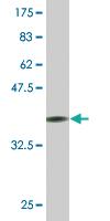 Anti-VPS18 Mouse Monoclonal Antibody [clone: 4F8]