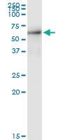 Anti-SPATA2 Polyclonal Antibody Pair