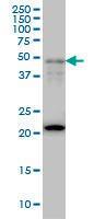 Anti-FOXA2 Mouse monoclonal antibody [clone: 2F12]