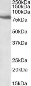 Anti-BBS7 Antibody (A83000) (1µg/ml) staining of Human Skeletal Muscle lysate (35µg protein in RIPA buffer). Primary incubation was 1 hour. Detected by chemiluminescence.