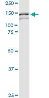 Anti-ARHGEF11 Mouse Monoclonal Antibody [clone: 2F4]