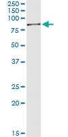 Anti-SWAP70 Polyclonal Antibody Pair