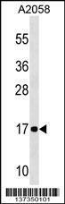 Anti-NDUFA12 Rabbit Polyclonal Antibody (HRP (Horseradish Peroxidase))