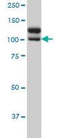 Anti-NEK9 Mouse Monoclonal Antibody [clone: 1F6]