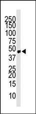 Anti-CCBP2 Rabbit Polyclonal Antibody (Biotin)