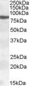 Anti-ALOX15 Antibody (A84615) (0.2 µg/ml) staining of nuclear HeLa lysate (35 µg protein in RIPA buffer). Detected by chemiluminescence