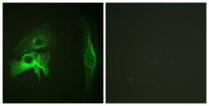 Antibody anti-PAK1 A95353-100 100 µg