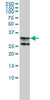 Anti-HNRNPA2B1 Mouse Monoclonal Antibody [clone: 1G12-6C5]