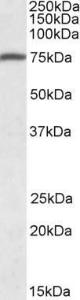 Anti-FERMT3 Antibody (A83001) (1µg/ml) staining of Human Peripheral Blood Mononucleocytes lysate (35µg protein in RIPA buffer). Primary incubation was 1 hour. Detected by chemiluminescence.