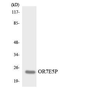 Western blot analysis of the lysates from COLO205 cells using Anti-OR7E5P Antibody