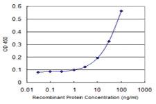 Anti-SV2C Mouse Monoclonal Antibody [clone: 3D8]