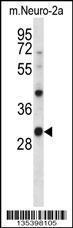 Anti-CSNK1A1 Rabbit Polyclonal Antibody (FITC (Fluorescein Isothiocyanate))