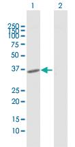 Anti-FOXH1 Rabbit Polyclonal Antibody