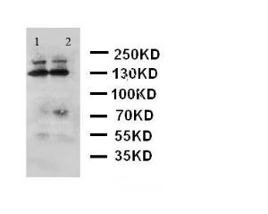 Anti-ADAMTS4 Rabbit Polyclonal Antibody