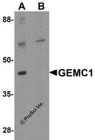 Western blot analysis of CCDC141 in SK-N-SH cell tissue lysate with CCDC141 antibody at 1 &#956;g/mL in (A) the absence and (B) the presence of blocking peptide.