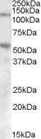 Anti-PALLD Antibody (A84616) (0.1 µg/ml) staining of Human Umbillical Cord lysate (35 µg protein in RIPA buffer) with (B) and without (A) blocking with the immunising peptide. Primary incubation was 1 hour. Detected by chemiluminescence