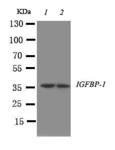 Anti-IGFBP1 Rabbit Polyclonal Antibody