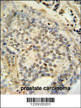 Anti-FUS Rabbit Polyclonal Antibody (FITC (Fluorescein Isothiocyanate))