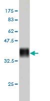 Anti-CENPJ Mouse Monoclonal Antibody [clone: 5D5]