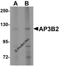 Western blot analysis of SPRYD4 in mouse kidney tissue lysate with SPRYD4 antibody at 1 &#956;g/mL in (A) the absence and (B) the presence of blocking peptide.