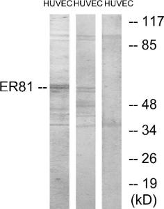 Western blot analysis of lysates from HUVEC cells, treated with PMA 125 ng/ml 30' using Anti-ER81 Antibody. The right hand lane represents a negative control, where the antibody is blocked by the immunising peptide