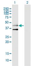 Anti-HTR3B Mouse Polyclonal Antibody