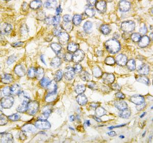 Anti-AIMP2/p38 Rabbit Polyclonal Antibody