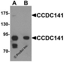 Western blot analysis of CCDC141 in SK-N-SH cell tissue lysate with CCDC141 antibody at 1 &#956;g/mL in (A) the absence and (B) the presence of blocking peptide.