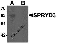 Western blot analysis of SPRYD3 in human brain tissue lysate with SPRYD3 antibody at 1 &#956;g/mL in (A) the absence and (B) the presence of blocking peptide.