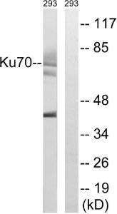 Western blot analysis of lysates from 293 cells using Anti-Ku70 Antibody. The right hand lane represents a negative control, where the antibody is blocked by the immunising peptide