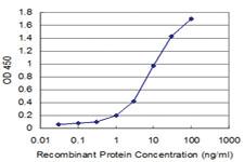 Anti-ABL2 Mouse Monoclonal Antibody [clone: 2H8]