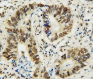 Anti-MTA1 Rabbit Polyclonal Antibody