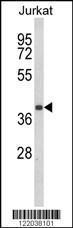 Anti-CCR3 Rabbit Polyclonal Antibody (FITC (Fluorescein))