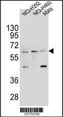 Anti-LILRA2 Rabbit Polyclonal Antibody (AP (Alkaline Phosphatase))